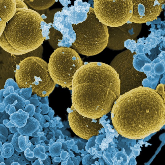 Staphylococcus aureauMagnification 20,000